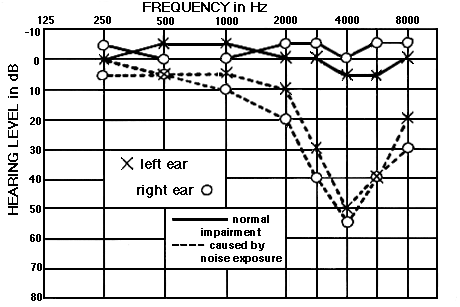 Ear Damage Diagram